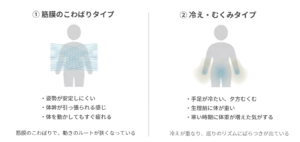 筋膜のこわばりタイプと冷え・むくみタイプの違いを比較したイラスト