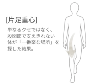 股関節で体を支えにくいため、楽な側へ体重を移した片足重心の状態