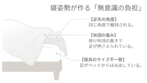足先の角度、掛け布団の重み、寝具とのサイズ不一致が足に負担をかける様子